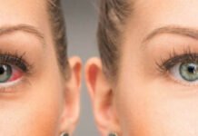 NO PIERDAS DE VISTA LOS SÍNTOMAS DEL GLAUCOMA