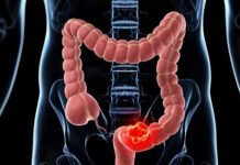 ALERTA SI TE PASA ESTO!